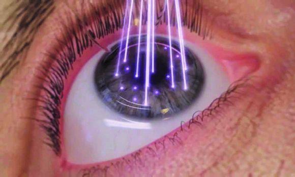 دستگاه یک میلیاردی تصویربرداری لیزری از چشم بومی سازی شد