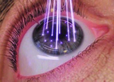 دستگاه یک میلیاردی تصویربرداری لیزری از چشم بومی سازی شد